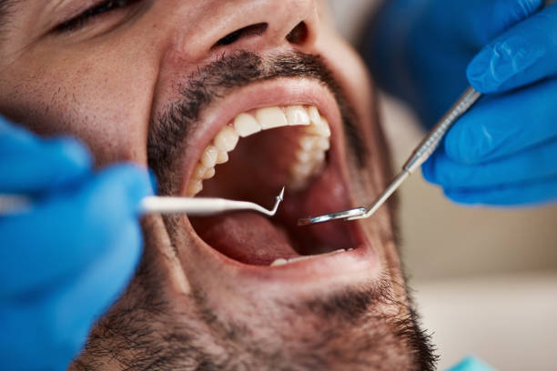 Best Emergency Cosmetic Dentistry (e.g., broken veneers) in Del Rey, CA